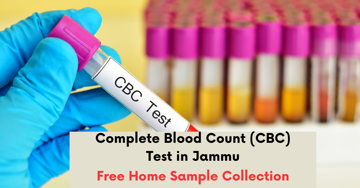 Complete Blood Count (CBC) Test Price in Jammu | O-Lab