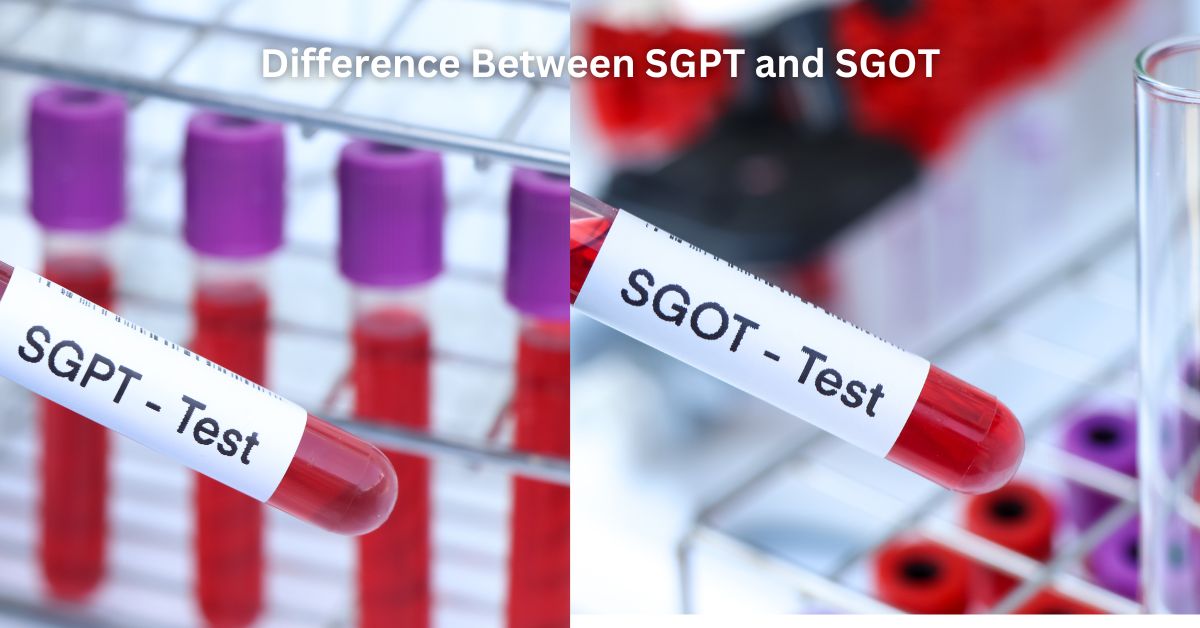 Difference Between SGPT and SGOT: Enzyme, Function And Test Procedure  | O-Lab