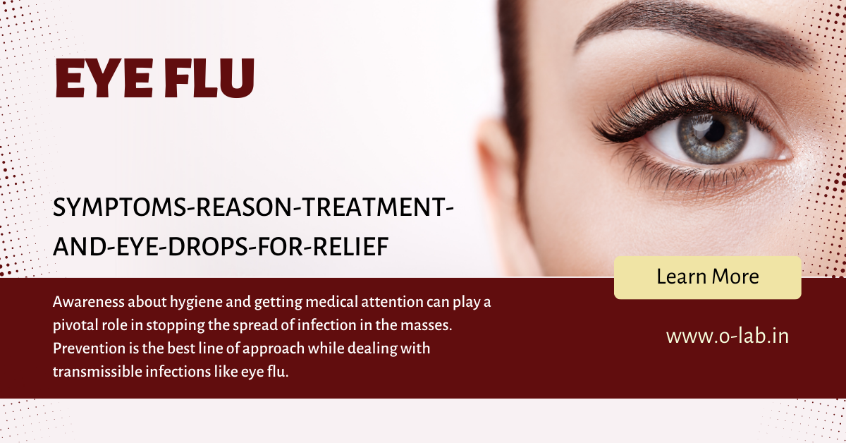 Understanding Eye Flu Symptoms, Causes, Treatment, and Relief with Eye Drops | O-Lab