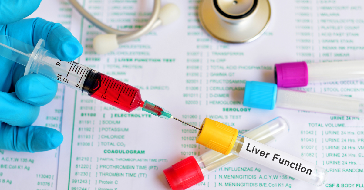 Liver Function Test (LFT) Price in Jammu | O-Lab