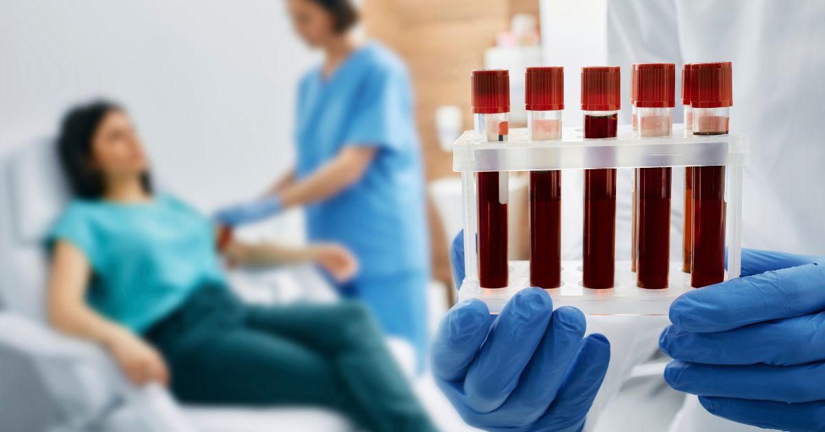 CBP Blood Test: Means, Costs, Uses, And Normal Ranges  | O-Lab