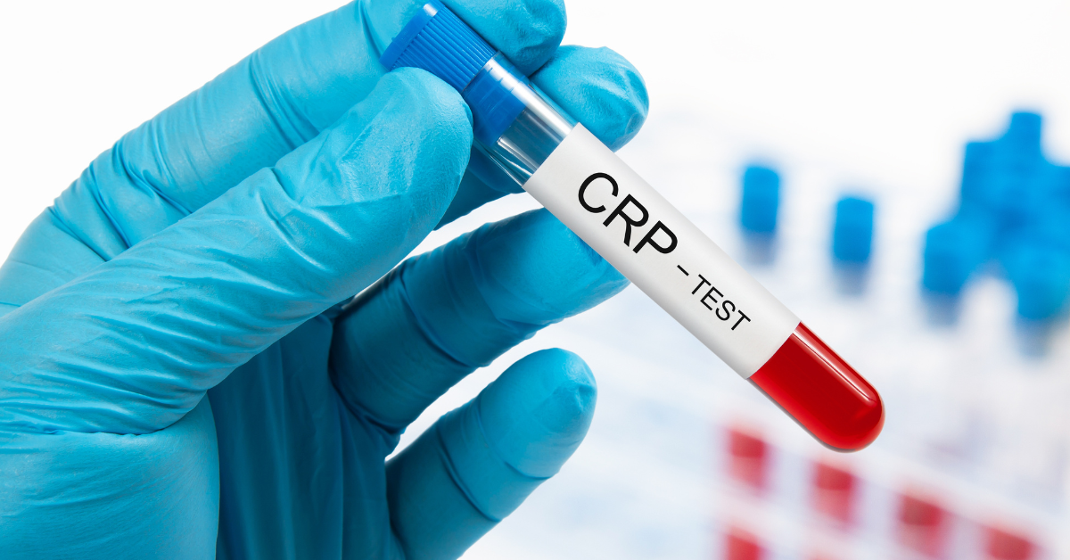 How Much CRP Level Is Dangerous: Causes, Risks & Management | O-Lab
