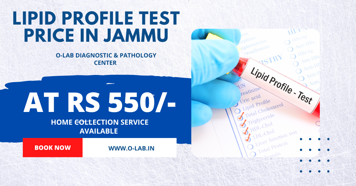 Lipid Profile Test Guide: Understanding Cardiovascular Health | O-Lab Jammu Prices  | O-Lab