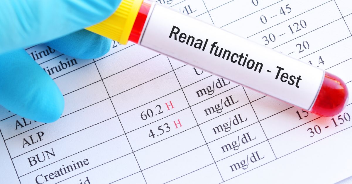 Renal Profile Blood Tests: Parameters, Normal Values, and Cost | O-Lab