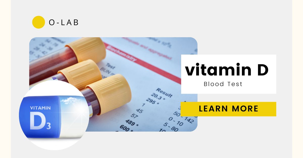 Vitamin D Blood Test Cost- All You Need To Know About This Superhero  | O-Lab